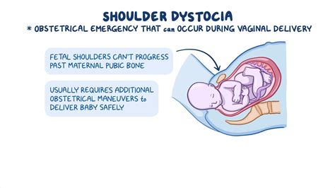 alarm shoulder dystocia|what is shoulder dystocia.